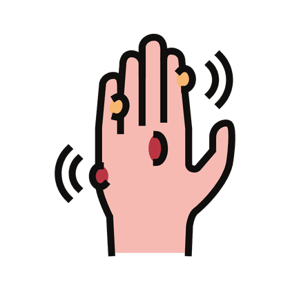 Warzen und Papillome