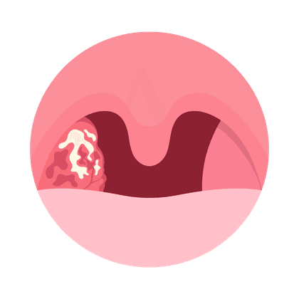 Adenoide bei Kindern