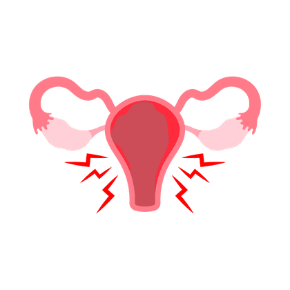 Endometriose